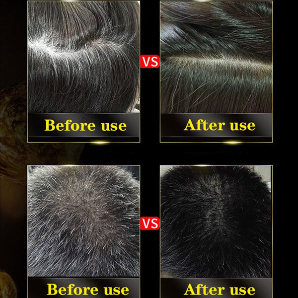 Japanese 3 in 1 Black Hair Dye Shampoo (BUY 1 GET 1 FREE)✨✨